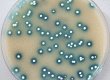 Streptomyces overlaid with XGluc