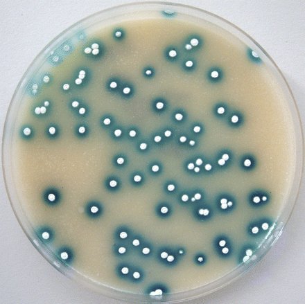 Streptomyces overlaid with XGluc